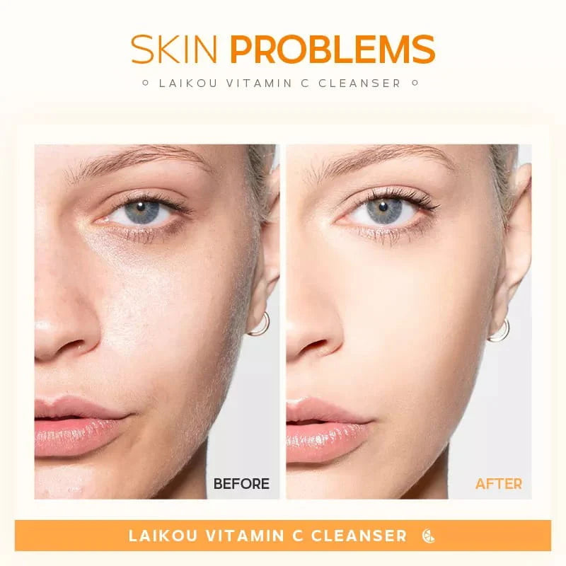LAIKOU Vitamin C Whitening Cleanser | 50g