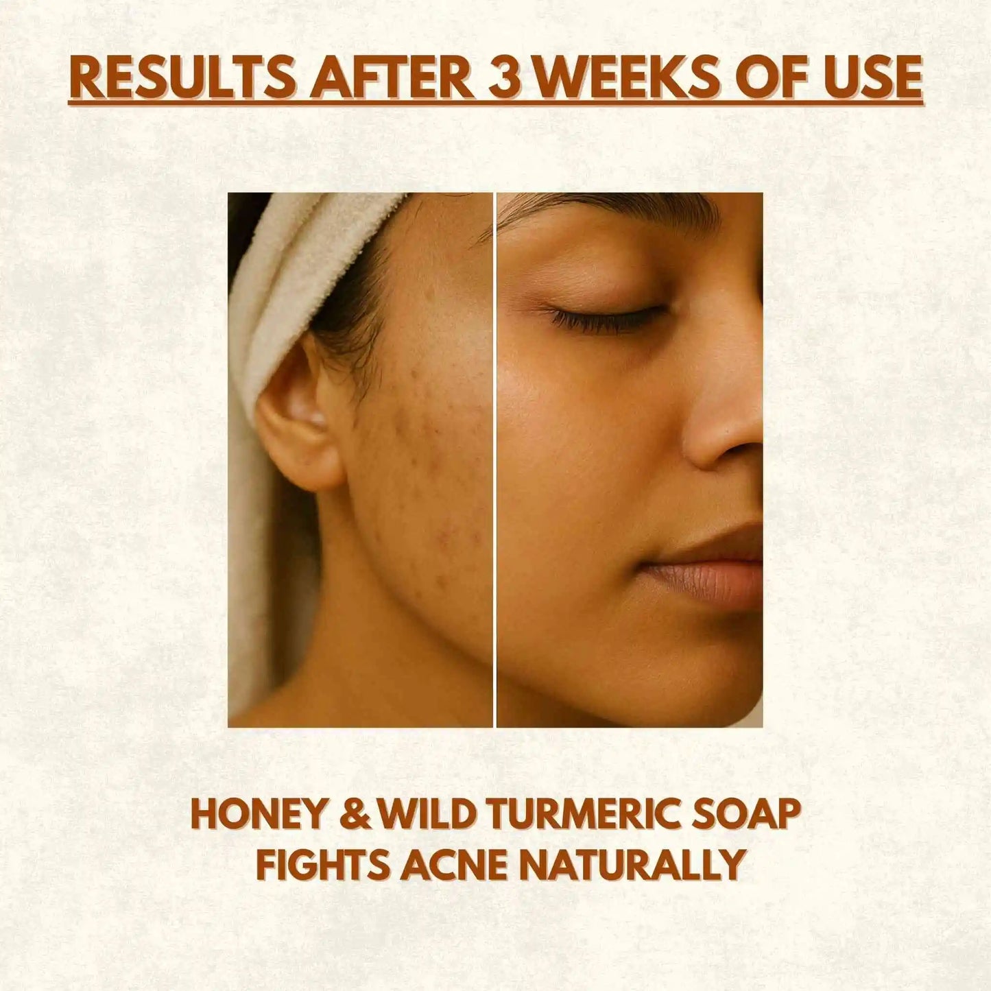 Honey & Wild Turmeric Organic Golden Glow Soap | 100g