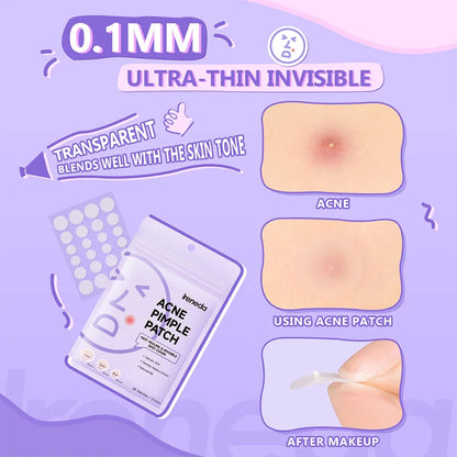 Ireneda Acne Pimple Patch – hydrocolloid spot treatment for fast pimple healing. Absorbs oil & impurities, reduces redness & prevents irritation. Halal, vegan, and cruelty-free skincare in Pakistan.