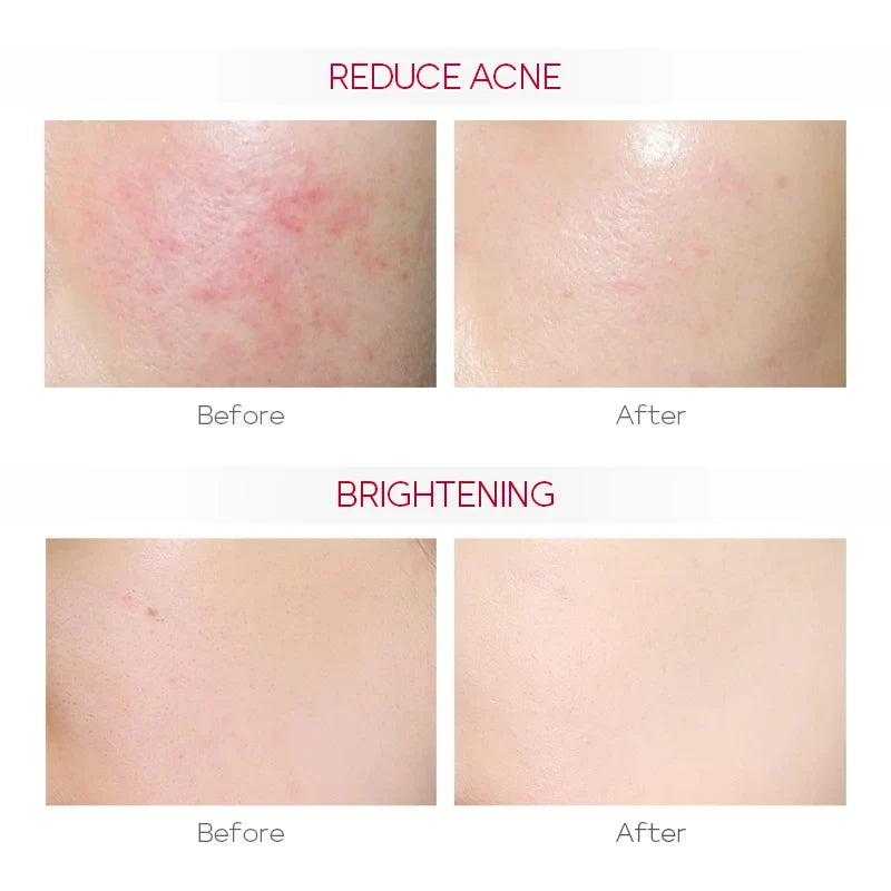 LAIKOU Pro-Niacinamide Brightening Serum | 17ml