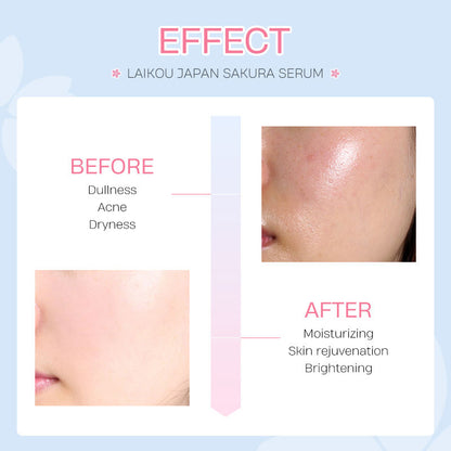 LAIKOU Skin Care Facial Whitening Sakura Face Serum - 1ml
