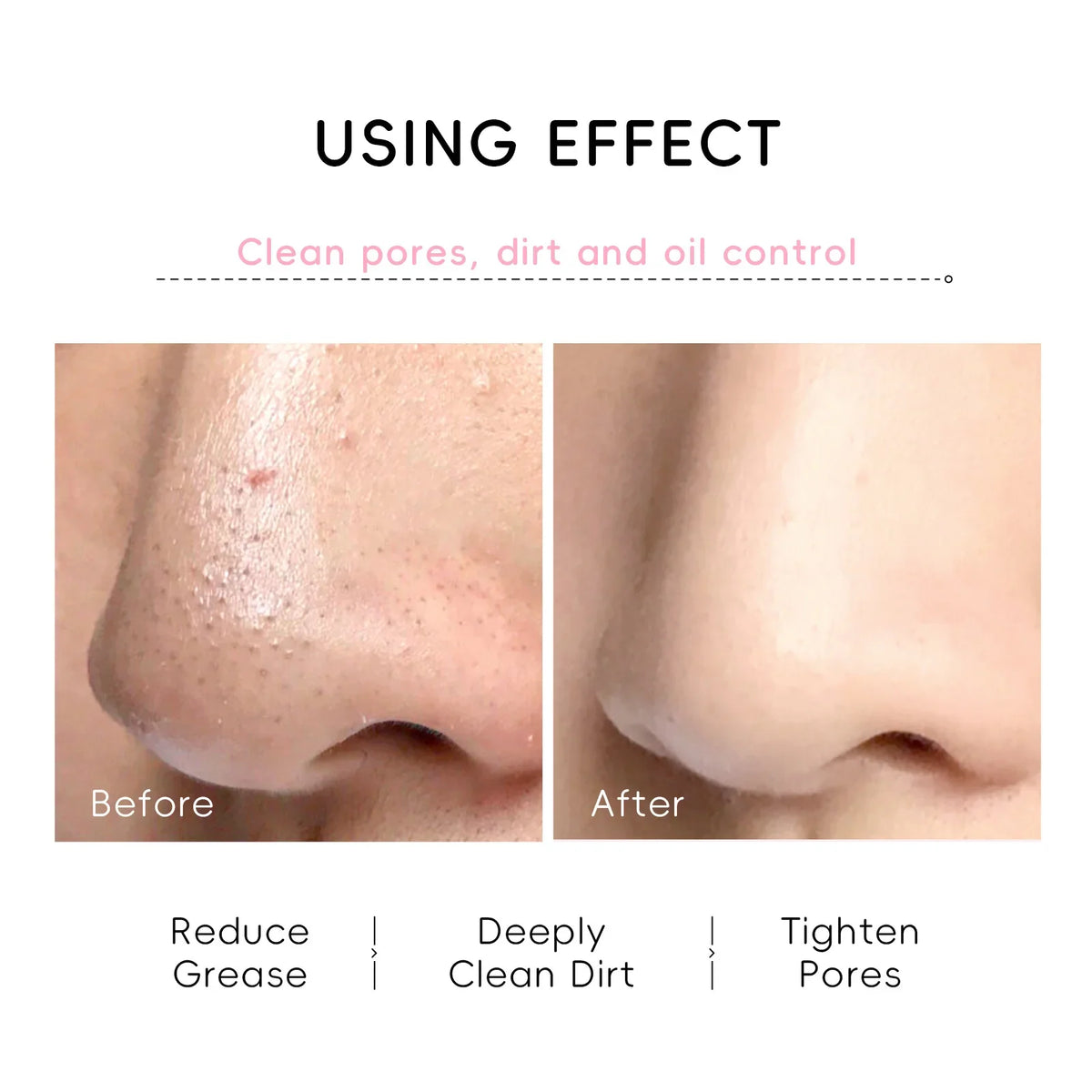 LAIKOU Japan Sakura Peel Off Nose Mask | 30g
