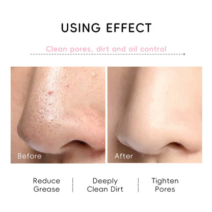 LAIKOU Japan Sakura Peel Off Nose Mask | 30g