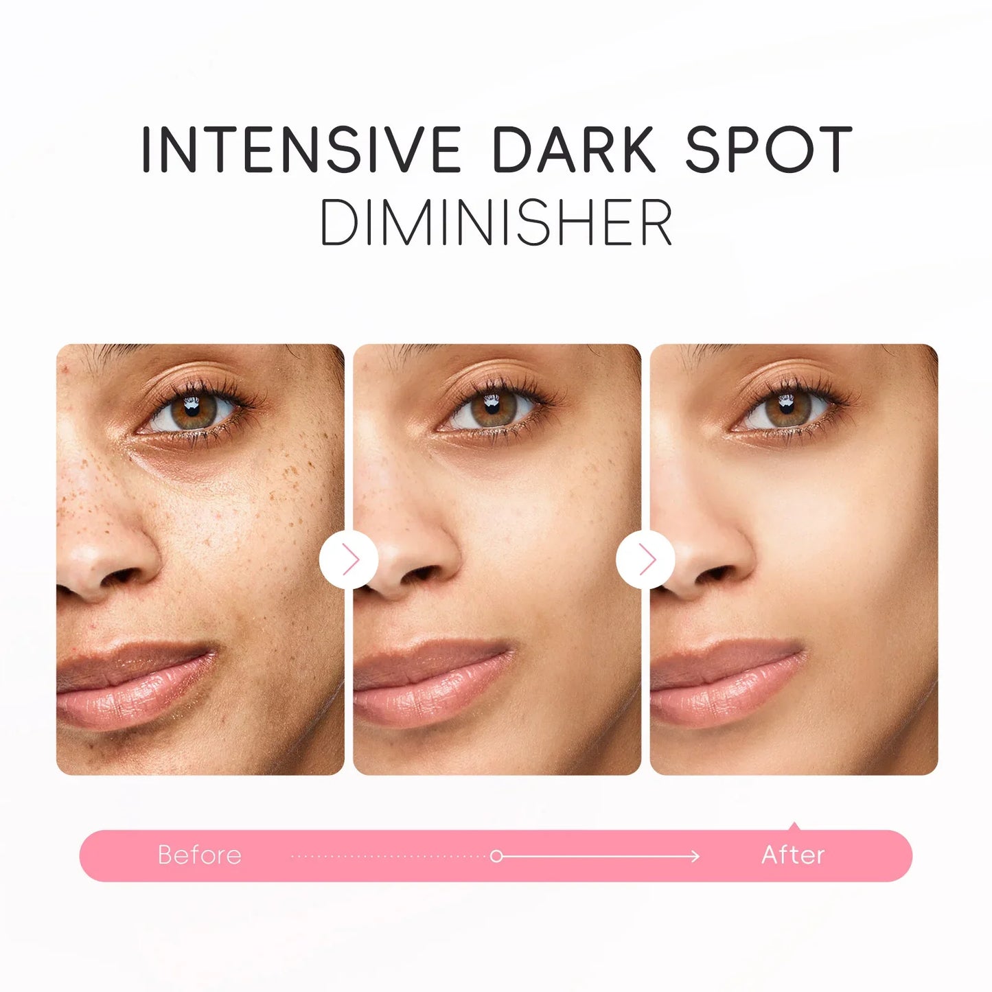 LAIKOU Japan Sakura Dark Spot Corrector Cream | 50g