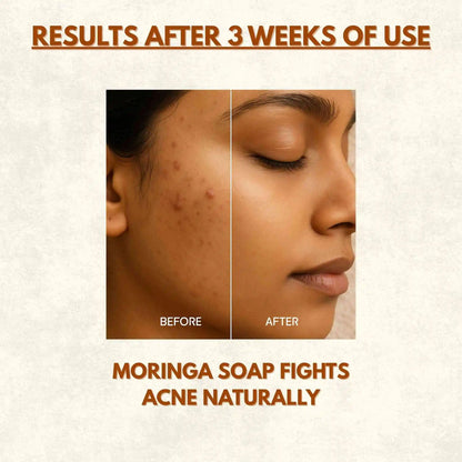 Moringa Green Radiance Organic Soap | 100g