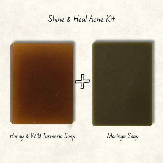 🌿 Shine and Heal Acne Kit